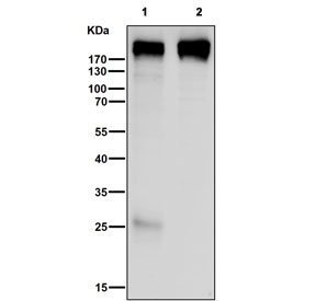 Western blot testing of human 1) A431 and 2) HT-29 cell lysate with Collagen XVII antibody. Expected molecular weight ~120 kDa and ~180 kDa.