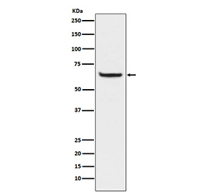 Phospho-NF-kB p65 Antibody HeLa WB. Western blot analysis of human HeLa cell lysate treated with Calyculin A and TNF-alpha using phospho-NF-kB p65 antibody detecting p65 phosphorylated at Ser529, clone AbN84. A band is observed at approximately 65-70 kDa, consistent with the predicted molecular weight of p65. Detection under stimulation conditions is consistent with phosphorylation-associated activation of NF-kB signaling.