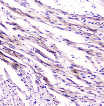 FABP3 Antibody Rat Cardiac Tissue Immunohistochemistry. IHC testing of FFPE rat heart tissue with FABP3 antibody at 1ug/ml. HIER: boil tissue sections in pH6, 10mM citrate buffer, for 10-20 min followed by cooling at RT for 20 min.