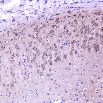 IHC staining of FFPE rat brain with Cortactin antibody at 1ug/ml. HIER: boil tissue sections in pH6, 10mM citrate buffer, for 10-20 min followed by cooling at RT for 20 min.