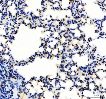 IHC staining of FFPE mouse lung tissue with SP1 antibody. HIER: boil tissue sections in pH8 EDTA for 20 min and allow to cool before testing.