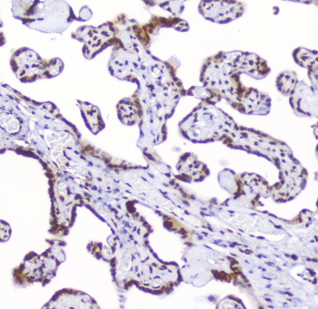 AHR Antibody Placental Villi IHC. Immunohistochemical staining of FFPE human placenta demonstrates AHR expression using an AHR antibody at 1 ug/ml. AHR, also known as Aryl Hydrocarbon Receptor and an Environmental Sensor Protein, is a ligand activated transcription factor that regulates xenobiotic metabolism, developmental signaling, and immune tolerance at the maternal fetal interface. Focal nuclear and cytoplasmic staining is observed in trophoblastic cells lining the chorionic villi, consistent with the role of AHR in placental homeostasis and responses to endogenous metabolites. Heat induced epitope retrieval was performed by boiling tissue sections in pH 6 10 mM citrate buffer for 10-20 minutes followed by cooling at room temperature for 20 minutes. These results support the utility of AHR Antibody for studies of reproductive biology, developmental signaling, and environmental response pathways.
