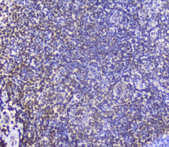 AHR Antibody Human Tonsil IHC. Immunohistochemical staining of FFPE human tonsil demonstrates AHR expression using an AHR antibody at 1 ug/ml. AHR, also known as Aryl Hydrocarbon Receptor and an Environmental Sensor Protein, is a ligand activated transcription factor that regulates immune cell differentiation and inflammatory signaling in response to endogenous metabolites and environmental ligands. Predominantly nuclear staining is observed in lymphoid cells within the tonsillar parenchyma and germinal center regions, consistent with the established role of AHR in adaptive immunity and maintenance of mucosal immune homeostasis. Heat induced epitope retrieval was performed by boiling tissue sections in pH 6 10 mM citrate buffer for 10-20 minutes followed by cooling at room temperature for 20 minutes. These results support the utility of AHR Antibody for studies of immunology, lymphocyte biology, and transcriptional regulation.