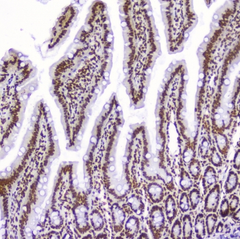 AHR Antibody Rat Small Intestine IHC. Immunohistochemical staining of FFPE rat small intestine demonstrates AHR expression using an AHR antibody at 1 ug/ml. AHR, also known as Aryl Hydrocarbon Receptor and an Environmental Sensor Protein, is a ligand activated transcription factor that integrates dietary, microbial, and xenobiotic signals to regulate intestinal homeostasis and mucosal immunity. Prominent nuclear staining is observed throughout the villous epithelium and crypt compartments, consistent with active AHR signaling in absorptive enterocytes and its established role in maintaining epithelial barrier integrity. Heat induced epitope retrieval was performed by boiling tissue sections in pH 6 10 mM citrate buffer for 10-20 minutes followed by cooling at room temperature for 20 minutes. These findings support the utility of AHR Antibody for studies of gastrointestinal physiology, host-microbiome interactions, and immune regulation.