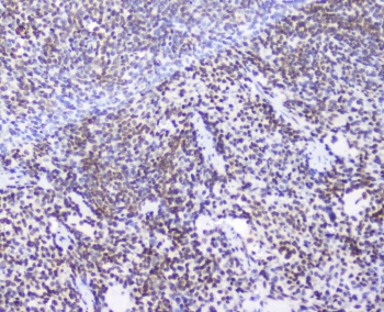 AHR Antibody Rat Spleen IHC. Immunohistochemical staining of FFPE rat spleen demonstrates AHR expression using an AHR antibody at 1 ug/ml. AHR, also known as Aryl Hydrocarbon Receptor and an Environmental Sensor Protein, is a ligand activated transcription factor that regulates immune cell differentiation and inflammatory responses through sensing of endogenous metabolites and environmental ligands. Widespread nuclear staining is observed throughout lymphoid regions, with prominent reactivity in splenic immune cell populations, consistent with the established role of AHR in maintaining immune homeostasis and modulating adaptive immunity. Heat induced epitope retrieval was performed by boiling tissue sections in pH 6 10 mM citrate buffer for 10-20 minutes followed by cooling at room temperature for 20 minutes. These results support the utility of AHR Antibody for studies of immunology, signal transduction, and environmental sensing mechanisms.