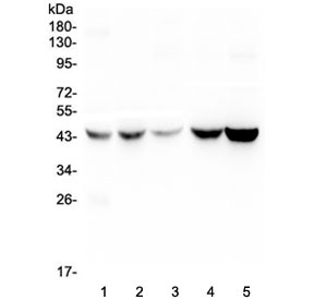 Alpha 1 Microglobulin Antibody WB. Western blot analysis of human 1) placenta, 2) HEp-2, 3) HeLa, 4) A549, and 5) PANC-1 lysates using Alpha 1 Microglobulin Antibody detects bands migrating between approximately 39-43 kDa, consistent with uncleaved Alpha-1-microglobulin-bikunin precursor / AMBP and glycosylated AMBP-associated protein species. This Protein HC antibody highlights extracellular glycoprotein-associated signaling and secretory pathway biology across epithelial and tumor-derived cell types. Higher apparent molecular weights are consistent with known glycosylation of AMBP-derived proteins.
