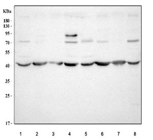 Western blot testing of 1) rat brain, 2) rat thymus, 3) rat spleen, 4) rat PC-12, 5) mouse brain, 6) mouse thymus, 7) mouse spleen and 8) mouse RAW264.7 cell lysate with Amphiregulin antibody at 0.5ug/ml.  Molecular weight: 28 kDa (non-glycosylated), ~50 kDa (glycosylated pro form), ~43 kDa (predominant glycosylated soluble form) as well as other, smaller, soluble and membrane bound forms.