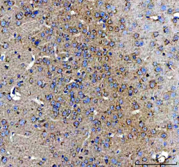 IHC staining of FFPE mouse brain tissue with Amphiregulin antibody. HIER: boil tissue sections in pH8 EDTA for 20 min and allow to cool before testing.