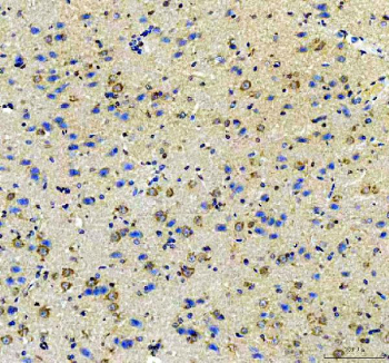 IHC staining of FFPE rat brain tissue with Amphiregulin antibody. HIER: boil tissue sections in pH8 EDTA for 20 min and allow to cool before testing.