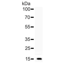 Western blot testing of human recombinant partial protein with BTC antibody.