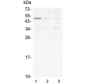 Western blot testing of human 1) PANC-1, 2) 22RV1 and 3) SGC-7901 cell lysate with Caspase-2 antibody at 0.5ug/ml. Predicted molecular weight: ~47 kDa (full), ~31 kDa (large+small subunit), ~20 kDa (large subunit).
