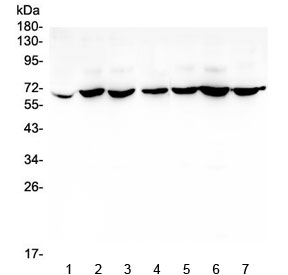 Western blot testing of human 1) placenta, 2) PC-3, 3) SW620, 4) THP-1, 5) MDA-MB-231, 6) K562 and 7) A431 lysate with CD1b antibody at 0.5ug/ml. The predicted molecular weight is ~37 kDa but is often observed higher due to glycosylation.
