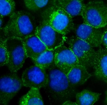 CDH3 Antibody A431 Cell IF. Immunofluorescence analysis of FFPE human A431 cells using CDH3 Antibody / Cadherin 3 Antibody. Heat induced antigen retrieval was performed by steaming sections in pH 6 citrate buffer for 20 minutes. CDH3 expression is shown in green with DAPI nuclear counterstain shown in blue. Strong membrane-associated staining is observed at epithelial cell junctions, supporting the use of CDH3 Antibody / Cadherin 3 Antibody for studying Cadherin 3 protein expression, epithelial adhesion mechanisms and cell-cell communication pathways.