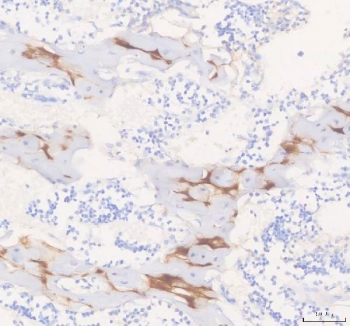 IHC staining of FFPE rat knee joint tissue with COMP antibody. HIER: boil tissue sections in pH8 EDTA for 20 min and allow to cool before testing.