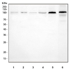 Western blot testing of 1) human HepG2, 2) human HaCaT, 3) human Caco-2, 4) human 293T, 5) rat cartilage and 6) mouse cartilage tissue lysate with COMP antibody at 0.5ug/ml. Expected molecular weight: 83-100 kDa depending on glycosylation level.