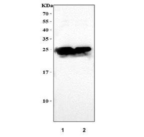 Western blot testing of human recombinant protein at 1) 10ng/lane and 2) 5ng/lane with C Reactive Protein antibody at 0.5ug/ml. Predicted molecular weight ~26 kDa.