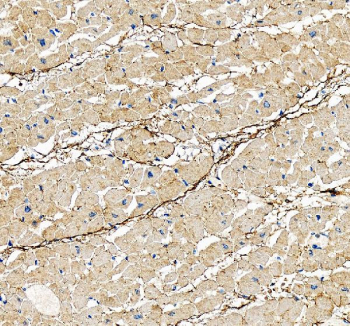 IHC staining of FFPE human heart tissue with DDR2 antibody, HRP-secondary and DAB substrate. HIER: boil tissue sections in pH8 EDTA for 20 min and allow to cool before testing.