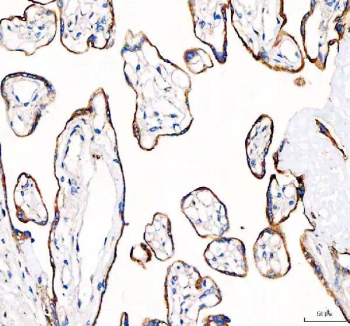 IHC staining of FFPE human placental tissue with EML4 antibody. HIER: boil tissue sections in pH8 EDTA for 20 min and allow to cool before testing.