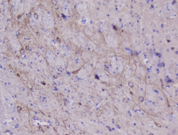 NSE Antibody Mouse Brain IHC. Immunohistochemistry staining of FFPE mouse brain with NSE antibody at 1ug/ml. HIER: boil tissue sections in pH6, 10mM citrate buffer, for 10-20 min followed by cooling at RT for 20 min.