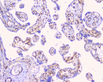 CD32 Antibody Placenta IHC. Immunohistochemistry staining of FFPE human placenta with CD32 antibody at 1ug/ml. HIER: boil tissue sections in pH6, 10mM citrate buffer, for 10-20 min followed by cooling at RT for 20 min.