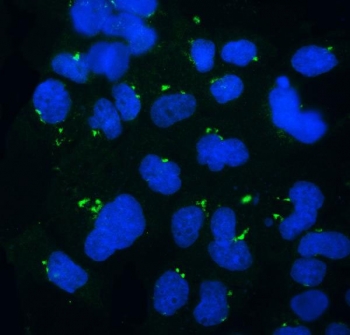 Immunofluorescent staining of FFPE human A431 cells with GOLPH3 antibody (green) and DAPI nuclear stain (blue). HIER: steam section in pH6 citrate buffer for 20 min.