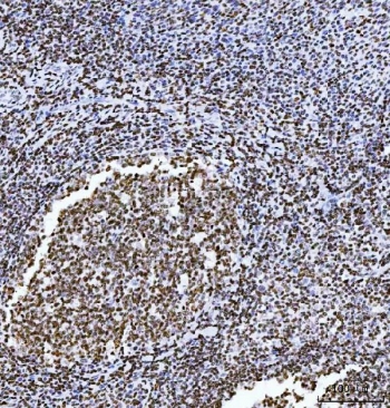 IHC staining of FFPE human tonsil tissue with HMGN2 antibody. HIER: boil tissue sections in pH8 EDTA for 20 min and allow to cool before testing.