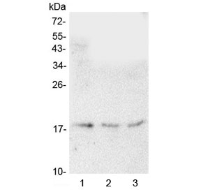 Western blot testing of human 1) HeLa, 2) A549 and 3) U-87 MG cell lysate with HMGN2 antibody at 0.5ug/ml. Predicted molecular weight ~18 kDa.