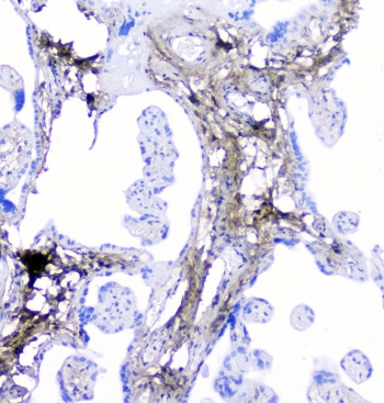 IHC staining of FFPE human placenta with LUM antibody at 1ug/ml. HIER: boil tissue sections in pH6, 10mM citrate buffer, for 10-20 min followed by cooling at RT for 20 min.