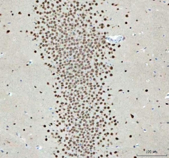 IHC staining of FFPE rat brain tissue with NOVA1 antibody. HIER: boil tissue sections in pH8 EDTA for 20 min and allow to cool before testing.
