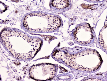 RAD51 Antibody Human Testis IHC. Immunohistochemical staining of FFPE human testis demonstrates RAD51 expression using a RAD51 antibody at 1 ug/ml. RAD51, also known as RAD51 Recombinase, is a key DNA repair protein that mediates homologous recombination and maintains genomic stability during meiosis and spermatogenesis. Predominantly nuclear staining is observed within seminiferous tubules, consistent with the high levels of DNA repair activity required for germ cell development. Heat induced epitope retrieval was performed by boiling tissue sections in pH6 10 mM citrate buffer for 10 to 20 minutes followed by cooling at room temperature for 20 minutes prior to staining. These results support the utility of RAD51 Antibody for investigating DNA damage responses, meiotic recombination, and reproductive biology.