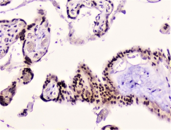RAD51 Antibody Human Placenta IHC. Immunohistochemical staining of FFPE human placenta demonstrates RAD51 expression using a RAD51 antibody. RAD51, also known as RAD51 Recombinase, is a key DNA repair protein involved in homologous recombination and the maintenance of genomic stability. Strong nuclear staining is observed in trophoblastic epithelial cells, consistent with the high proliferative activity and DNA repair requirements of placental tissues. Heat induced epitope retrieval was performed by boiling tissue sections in pH6 10 mM citrate buffer for 10 to 20 minutes followed by cooling prior to staining. These results support the utility of RAD51 Antibody for investigating DNA damage responses, genome maintenance, and developmental biology.
