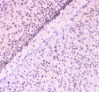 RAD51 Antibody Mouse Brain IHC. Immunohistochemical staining of FFPE mouse brain demonstrates RAD51 expression using a RAD51 antibody at 1 ug/ml. RAD51, also known as RAD51 Recombinase, is a central DNA repair protein that mediates homologous recombination and maintains genomic stability. Predominantly nuclear staining is observed in cells of the cerebellar granular layer, consistent with the requirement for efficient DNA damage responses in neural tissues. Heat induced epitope retrieval was performed by boiling tissue sections in pH6 10 mM citrate buffer for 10 to 20 minutes followed by cooling at room temperature for 20 minutes prior to staining. These results support the utility of RAD51 Antibody for investigating DNA repair pathways, genome maintenance, and nervous system development.