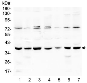 RAD51 Antibody Human Cell Lines WB. Western blot analysis of RAD51 expression using a RAD51 antibody at 0.5 ug/ml. Lane 1: human HeLa cell lysate. Lane 2: human A431 cell lysate. Lane 3: human 293T cell lysate. Lane 4: human K562 cell lysate. Lane 5: human Jurkat cell lysate. Lane 6: human A549 cell lysate. Lane 7: human Caco-2 cell lysate. RAD51, also known as RAD51 Recombinase, is a key DNA repair protein that mediates homologous recombination and preserves genomic stability. A prominent band is detected at approximately 37 kDa in all cell lines, consistent with the predicted molecular weight of RAD51. Faint higher molecular weight bands are also observed in some lysates and may represent post translationally modified or multimeric forms of RAD51. These results demonstrate endogenous expression of this DNA repair protein across multiple human cell types and support the utility of RAD51 Antibody for studies of DNA damage responses, genome maintenance, and cancer biology.
