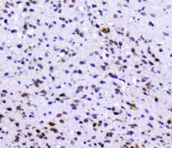 RAD51 Antibody Rat Brain IHC. Immunohistochemical staining of FFPE rat brain demonstrates RAD51 expression using a RAD51 antibody at 1 ug/ml. RAD51, also known as RAD51 Recombinase, is a central DNA repair protein that mediates homologous recombination and preserves genomic stability in proliferating and differentiated cells. Predominantly nuclear staining is observed in scattered neural cells, consistent with the requirement for efficient DNA damage responses and chromosome maintenance in the nervous system. Heat induced epitope retrieval was performed by boiling tissue sections in pH6 10 mM citrate buffer for 10 to 20 minutes followed by cooling at room temperature for 20 minutes prior to staining. These results support the utility of RAD51 Antibody for investigating DNA repair pathways, genome maintenance, and neural development.