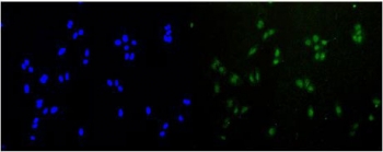 RAD51 Antibody U-2 OS Cells IF. Immunofluorescent staining of FFPE human U-2 OS cells demonstrates RAD51 expression using a RAD51 antibody (green) with DAPI nuclear counterstain (blue). RAD51, also known as RAD51 Recombinase, is a key DNA repair protein that mediates homologous recombination and maintains genomic stability following DNA damage. Predominantly nuclear localization is observed, consistent with the role of RAD51 in DNA double strand break repair and replication fork protection. Heat induced epitope retrieval was performed by steaming sections in pH6 citrate buffer for 20 minutes prior to staining. These results support the utility of RAD51 Antibody for investigating DNA damage responses, homologous recombination, and genome maintenance in human cells.