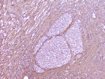 IHC staining of FFPE rat brain with SNAP25 antibody at 2ug/ml. HIER: boil tissue sections in pH6, 10mM citrate buffer, for 10-20 min followed by cooling at RT for 20 min.