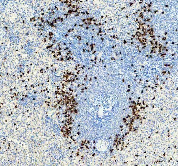 TNF Alpha Antibody Human Spleen IHC. Immunohistochemical staining of FFPE human spleen tissue with TNF alpha antibody at 2 ug/ml. Heat-induced epitope retrieval (HIER) was performed by boiling tissue sections in pH 8 EDTA buffer prior to staining. TNF alpha immunoreactivity is observed predominantly within scattered immune cells of the splenic white pulp and periarteriolar lymphoid regions, consistent with the expected localization of this pro-inflammatory cytokine involved in immune regulation, inflammatory signaling, and activation of innate and adaptive immune responses. Cell nuclei are counterstained with hematoxylin (blue).
