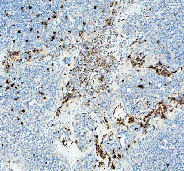 TNF Alpha Antibody Human Tonsil IHC. Immunohistochemical staining of FFPE human tonsil tissue with TNF alpha antibody at 2 ug/ml. Heat-induced epitope retrieval (HIER) was performed by boiling tissue sections in pH 8 EDTA buffer prior to staining. TNF alpha immunoreactivity is observed predominantly within scattered immune cells of the lymphoid tissue and interfollicular regions, consistent with the expected localization of this pro-inflammatory cytokine involved in immune regulation, inflammatory signaling, and activation of innate and adaptive immune responses. Cell nuclei are counterstained with hematoxylin (blue).
