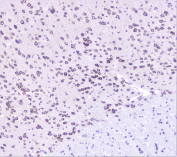 IHC staining of FFPE mouse brain with UBC9 antibody at 1ug/ml. HIER: boil tissue sections in pH6, 10mM citrate buffer, for 10-20 min followed by cooling at RT for 20 min.