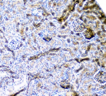IHC staining of FFPE mouse kidney with CD2AP antibody at 1ug/ml. HIER: boil tissue sections in pH6, 10mM citrate buffer, for 10-20 min followed by cooling at RT for 20 min.