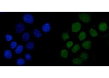 Immunofluorescent staining of FFPE human A431 cells with Anillin antibody (green) and DAPI nuclear stain (blue). HIER: steam section in pH6 citrate buffer for 20 min.