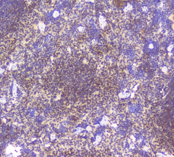 IHC staining of FFPE mouse spleen tissue with Bcl6 antibody at 1ug/ml. HIER: boil tissue sections in pH6, 10mM citrate buffer, for 10-20 min followed by cooling at RT for 20 min.