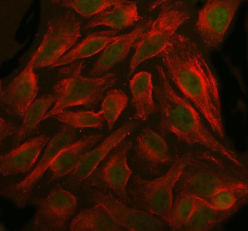 Immunofluorescent staining of FFPE human HeLa cells with DIS3 antibody (green) and Beta Tubulin mAb (red). HIER: steam section in pH6 citrate buffer for 20 min.