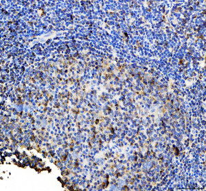 HLA-DRB1 Rabbit Polyclonal Antibody by IHC in Human Tonsil. Immunohistochemistry of FFPE human tonsil sections using HLA-DRB1 Rabbit Polyclonal Antibody. Strong membranous and cytoplasmic staining is observed in populations of lymphoid and antigen-presenting cells, with substantially lower staining in surrounding areas. The distribution is consistent with HLA-DR expression in immune-cell-rich tonsillar tissue and supports detection of the MHC class II DR beta chain by immunohistochemistry.
