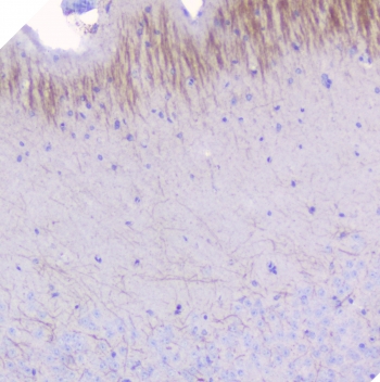 IHC staining of FFPE mouse brain with MOG antibody at 1ug/ml. HIER: boil tissue sections in pH6, 10mM citrate buffer, for 10-20 min followed by cooling at RT for 20 min.