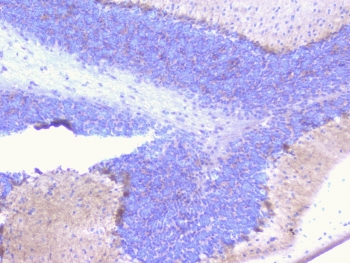 IHC staining of FFPE mouse brain with PCDH15 antibody at 1ug/ml. HIER: boil tissue sections in pH6, 10mM citrate buffer, for 10-20 min followed by cooling at RT for 20 min.