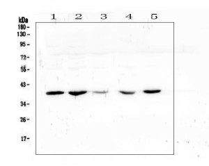 CD87 Antibody Human Cell and Tissue WB. Western blot analysis of human samples using CD87 Antibody at 0.5 ug/ml. Lane 1: human placenta tissue lysate, Lane 2: human U-2 OS cell lysate, Lane 3: human A431 cell lysate, Lane 4: human HeLa cell lysate, Lane 5: human A549 cell lysate. An HRP-conjugated secondary antibody with ECL substrate was used for detection. CD87 Antibody, recognizing uPAR/PLAUR, detects a prominent band at approximately 39 kDa, consistent with the expected molecular weight of the uPA receptor. This result supports detection of CD87, a cell surface receptor involved in immune cell activation, extracellular matrix remodeling, and cell migration signaling.