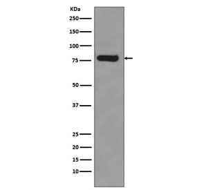 AR-V7 Antibody Rabbit Monoclonal (clone DHH-1) detects androgen receptor variant 7 protein in western blot analysis of human 22Rv1 cell lysate. A prominent band is observed at approximately 80 kDa, consistent with the commonly reported migration of AR-V7 on SDS-PAGE despite a predicted molecular weight of approximately 68 kDa. The higher apparent molecular weight reflects the intrinsically disordered N-terminal transactivation domain and post-translational influences that frequently cause AR splice variants to migrate more slowly during electrophoresis.