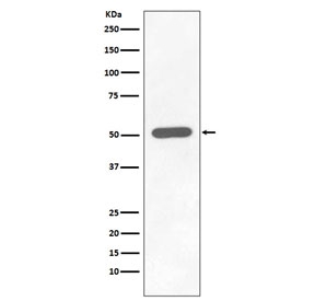 Phospho-CHK1 Antibody HEK293 WB. Western blot analysis of human HEK293 cell lysate treated with Calyculin A using phospho-CHK1 antibody detecting CHK1 phosphorylated at Ser296, clone FEO-3. A band is observed at approximately 54 kDa, consistent with the predicted molecular weight of CHK1. Detection under phosphatase inhibition conditions is consistent with phosphorylation-associated activation of DNA damage checkpoint signaling.