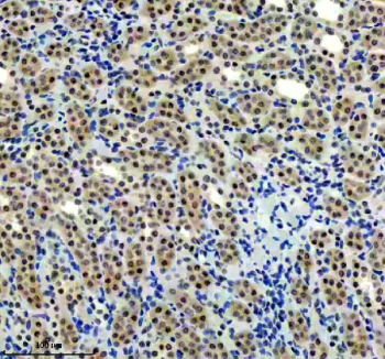 IHC staining of FFPE rat kidney tissue with p73 antibody, HRP-labeled secondary and DAB substrate. HIER: boil tissue sections in pH8 EDTA for 20 min and allow to cool before testing.